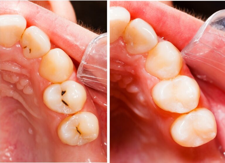 ЦООРЛЫН ЭМЧИЛГЭЭ