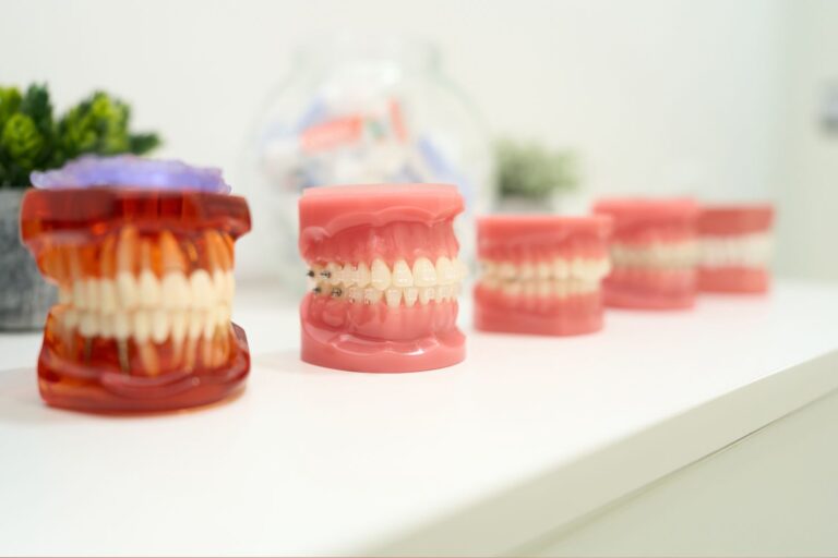 ШҮД ЭРҮҮ НҮҮРНИЙ ГАЖИГ